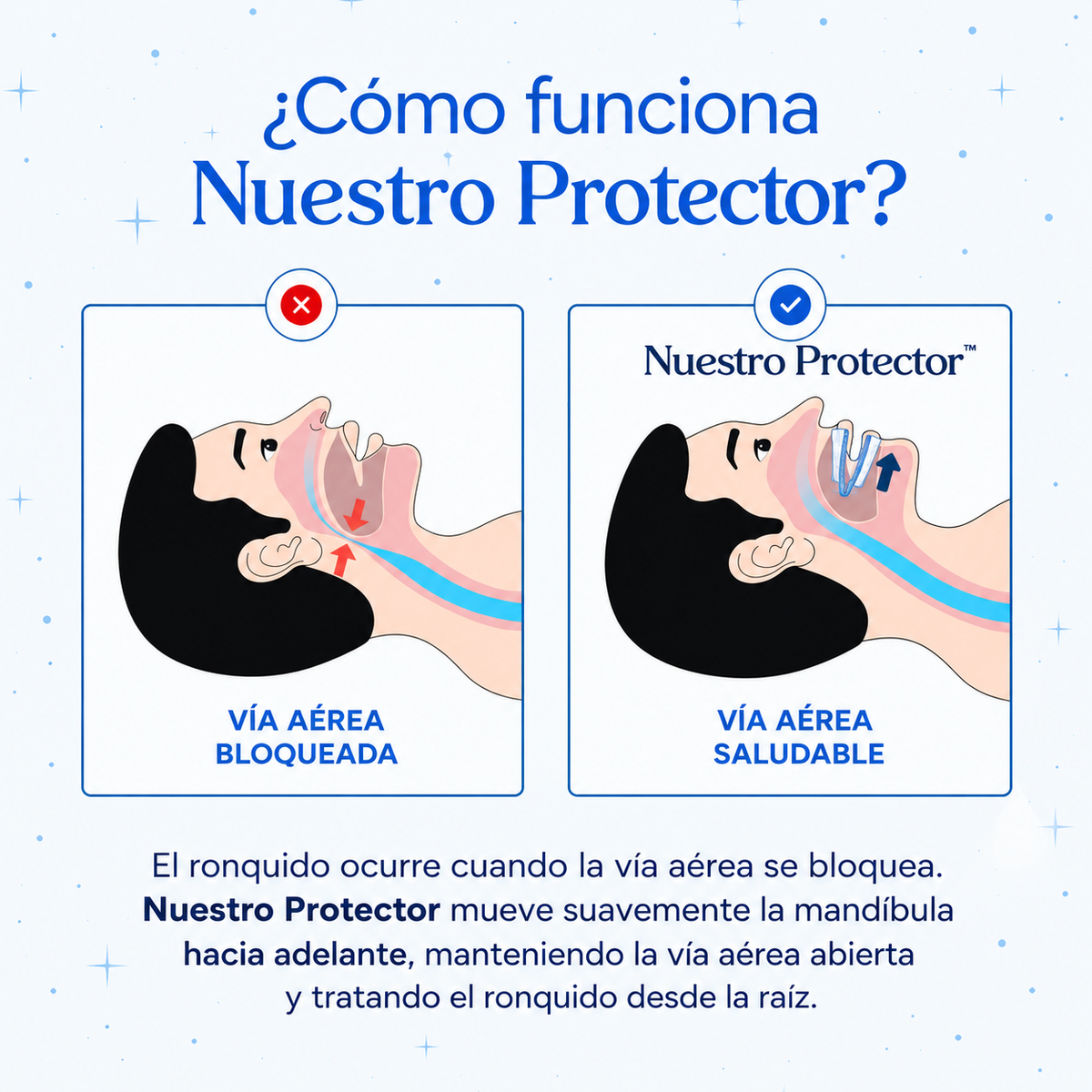 Protector bucal anti ronquido